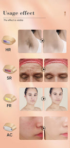 Adjustable intensity levels offer safe and customized treatments for different skin needs.