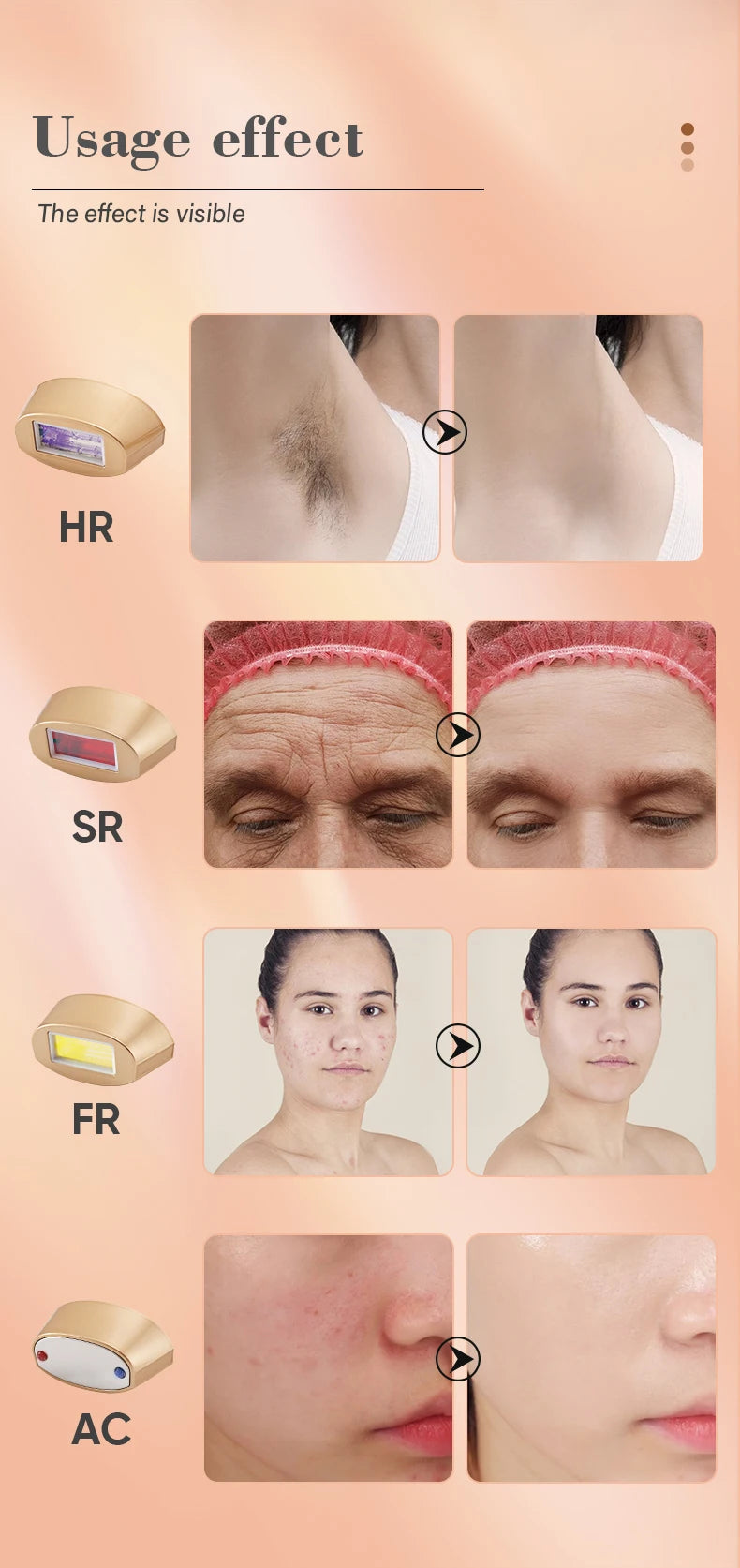 Adjustable intensity levels offer safe and customized treatments for different skin needs.